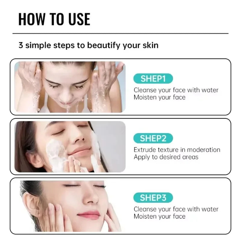 Effective Acne Removal Cream Anti-Acne Repair Redness Pimple Spots Gel Deep Cleaning Pore Oil Control Moisturizing Skin Care 30g Buyfinity